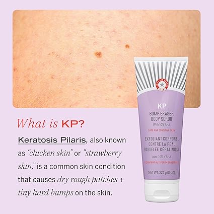 kp 2